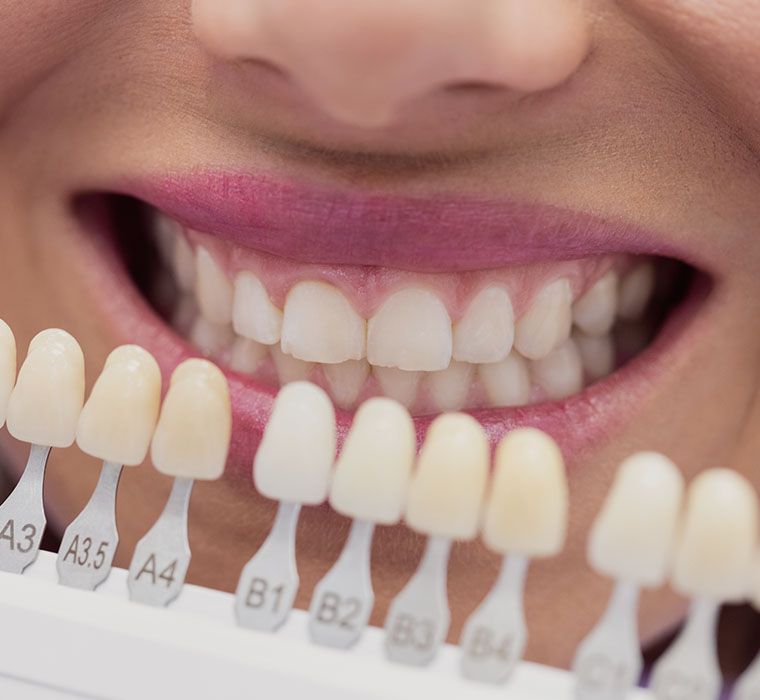 Dentist Examining Patient With Teeth Shades