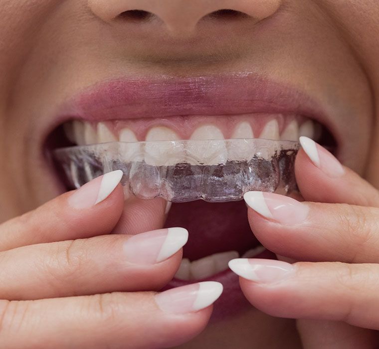 Woman Patient Wearing Braces