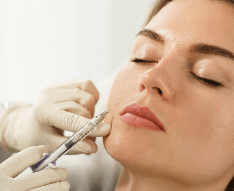 Smooth wrinkles using facial fillers